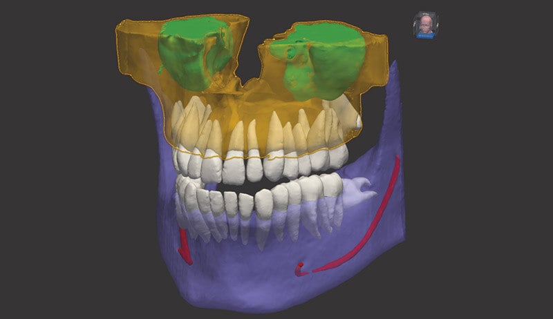 Neowise Visor 3D